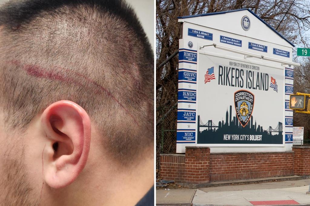 New York's correctional officers union is calling for the firing of its security chief after another attack on Rikers