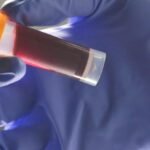 Your Blood Type Affects Your Risk of an Early Stroke, Scientists Discover : ScienceAlert