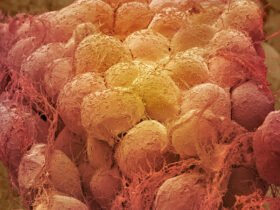 A scanning electron microscope image shows a close up of fat tissue in false color. The cells are rounded with strings of connective tissue attached.