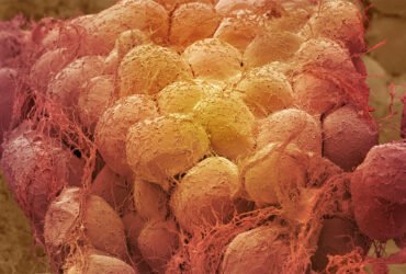 A scanning electron microscope image shows a close up of fat tissue in false color. The cells are rounded with strings of connective tissue attached.