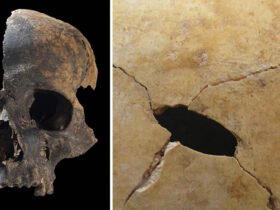 On the left, an image of the left side of a human skull, including the whole nose and mouth region, against a black background. On the right, a close-up of a sheet of bone with a puncture wound mark in it.