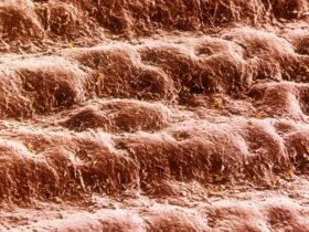 False-colour scanning electron micrograph of skin from the palm of the hand of a 30 year old man. The skin here is neatly arranged in ridges. Sweat pores are seen as miniature craters along the ridges. The cells forming the external surface of the skin, or epidermis, have been flattened & hardened by deposition within them of the fibrous protein keratin. This tough, dead layer of cells is shed continuously & is replaced by new, maturing cells which take a month to migrate from the base of the epidermis. Magnification: x20 at 6x4.5cm size