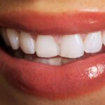 Close up on woman white teeth.