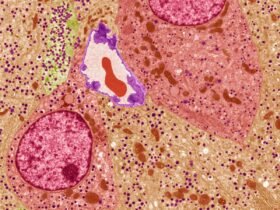 Gene-edited cells that evade rejection show promise in type 1 diabetes
