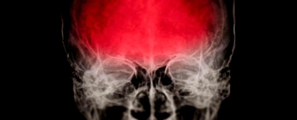 Serious Head Trauma May Awaken Dormant Viruses Inside Your Body : ScienceAlert