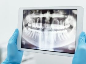 Chinese Woman Jumps Off Hospital Roof After Doctor Messes Up Tooth Extraction