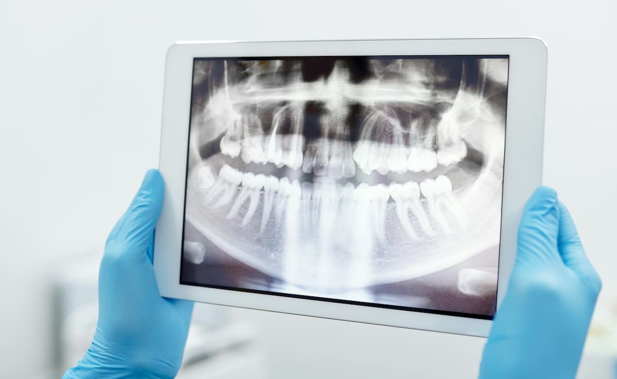 Chinese Woman Jumps Off Hospital Roof After Doctor Messes Up Tooth Extraction