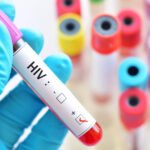 Every year HIV -vaccine knew the milestone of the key test