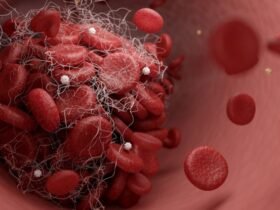 Expert Reveals 8 'Essential' Ways to Reduce Your Risk of Stroke : ScienceAlert