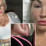 I spent £ 5k on a Turkey BBL, Boob Job, Lipo & Designer Vagina - I thought it would stimulate my career, instead I was cut off