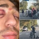 La driver attacked by Mob of teenage cyclists speaks out; 2 suspects arrested