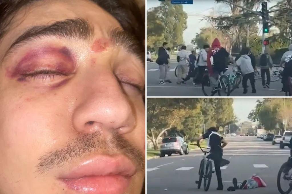 La driver attacked by Mob of teenage cyclists speaks out; 2 suspects arrested