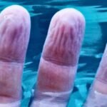 Mystery About The Way Fingers Wrinkle in Water Might Have an Answer : ScienceAlert