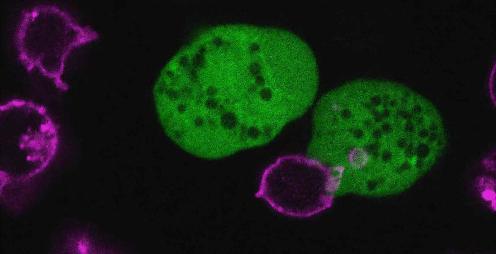 This parasite tears apart human cells and carries them as disguises